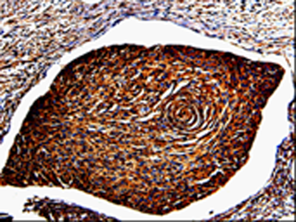 ANXA7