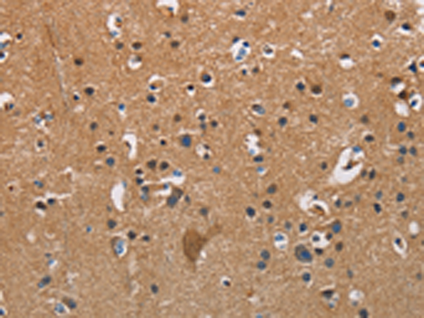 APOA1