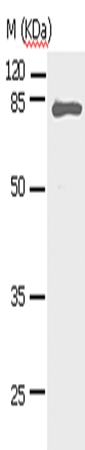 STAT5A