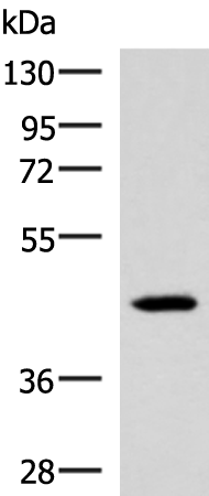IL18BP