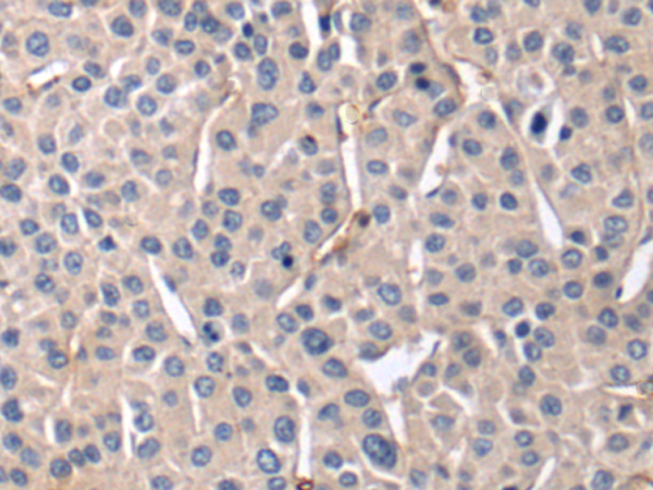 ABL1