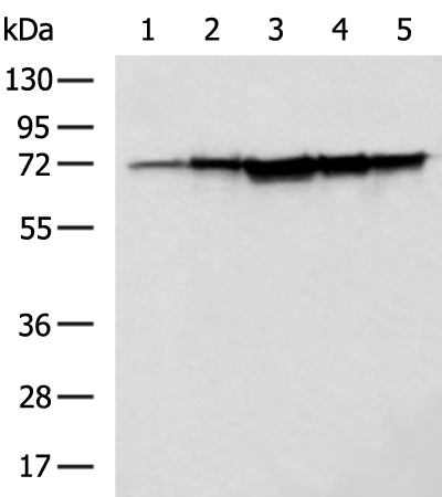 AIFM1