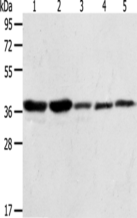 ANXA1