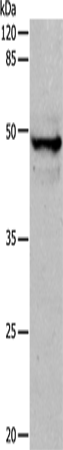 KRT15