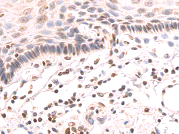 Rabbit Polyclonal Antibody to COL1A2