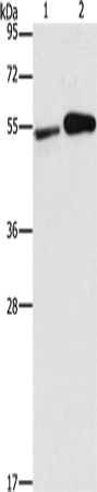 FSCN1