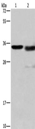 CTSL