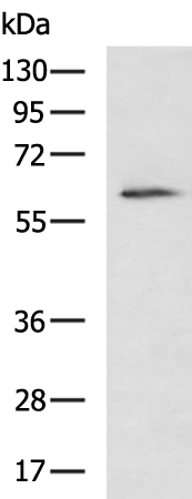 CDC25A