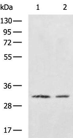 CDK5