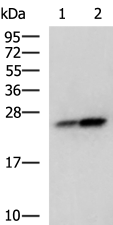 CDKN1B