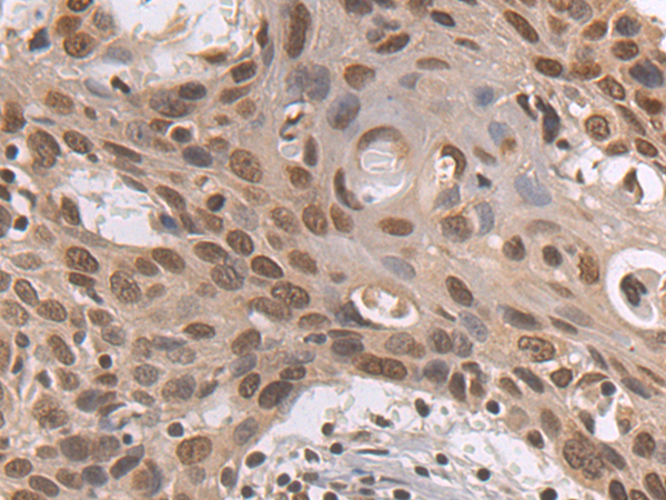 Rabbit Polyclonal Antibody to CEBPG