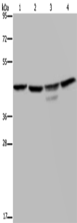 CSNK2A1