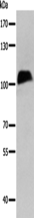 CTBP2