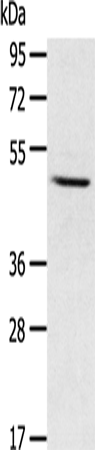 CYP1A1