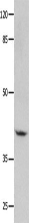 GNA11