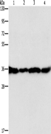 GNB1