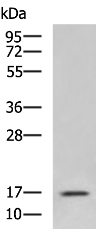 CSF2