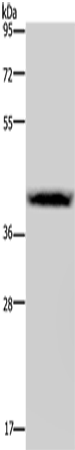 CSF2RA