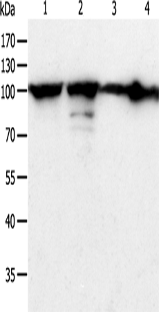 HSP90B1
