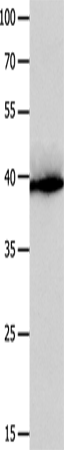 CFHR1
