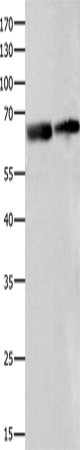 IGF2BP2