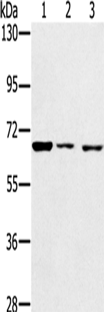 IGF2BP3