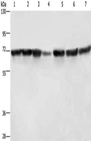 LMNB1