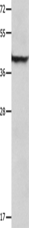 SERPINB5