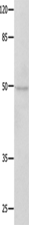 NAP1L1