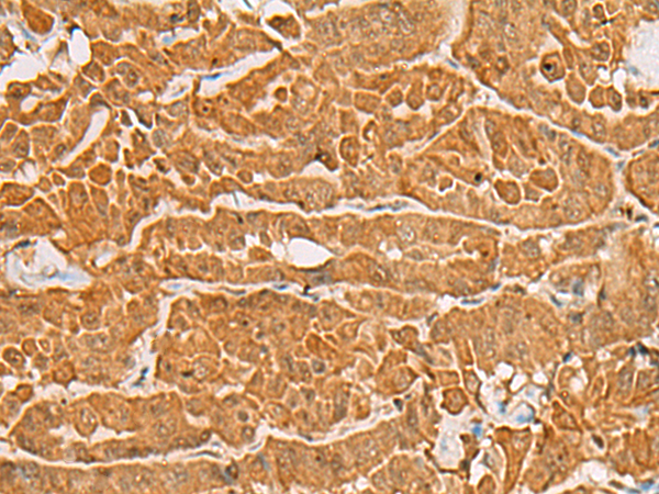 MAPK14