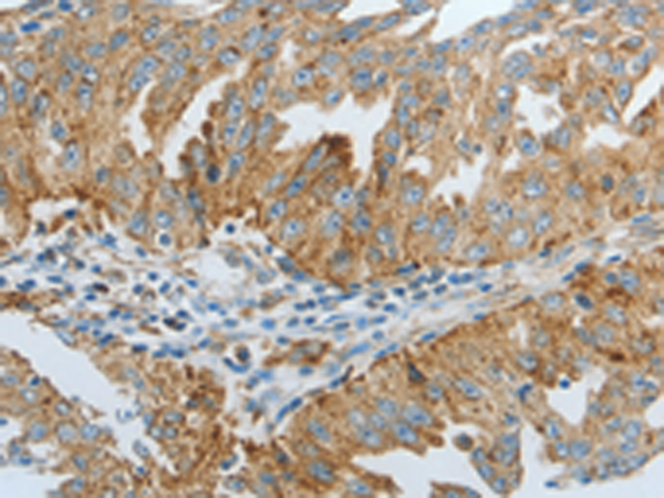 DNAJC10