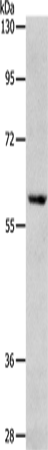 RPS6KB1