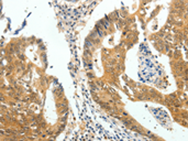 CDH23