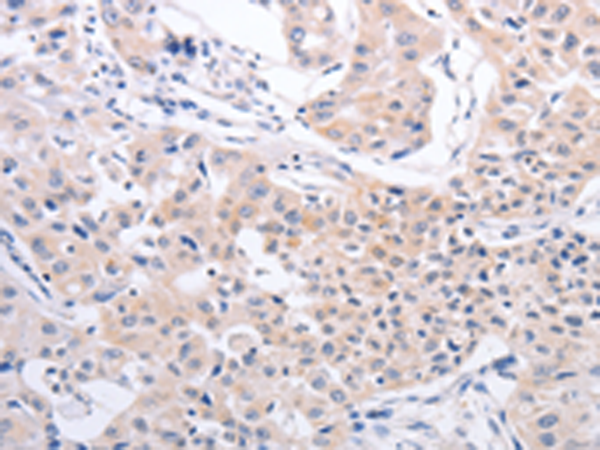 PFN4