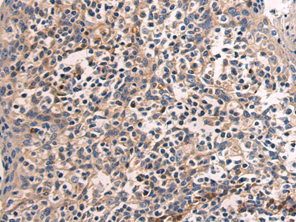 Rabbit Polyclonal Antibody to MAP3K9