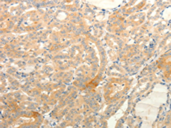 TPH1