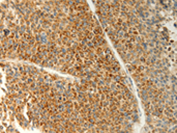 Rabbit Polyclonal Antibody to TRAF1