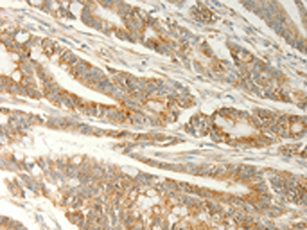 Rabbit Polyclonal Antibody to TRAF1