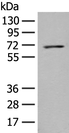 PPM1D