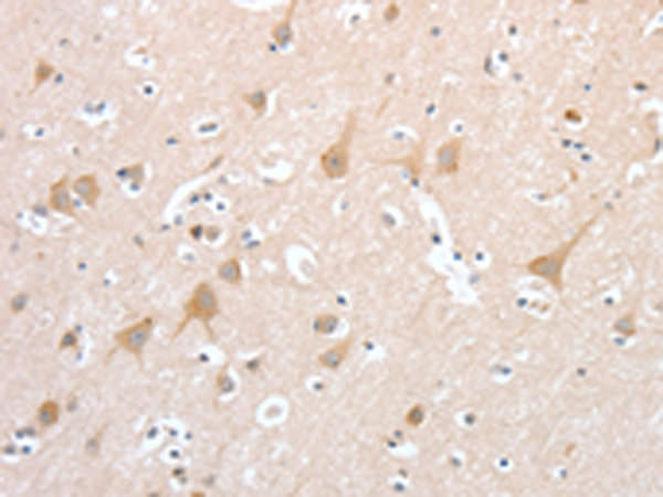 PCDHB16