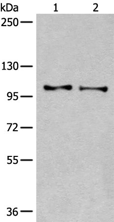 TMEM67