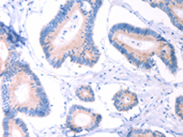 Rabbit Polyclonal Antibody to AADAC