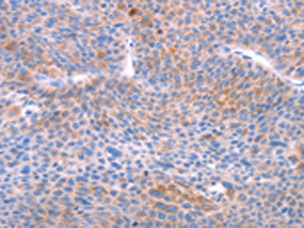 Rabbit Polyclonal Antibody to AADAC