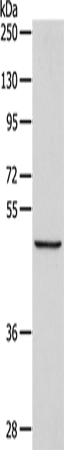 ALKBH1