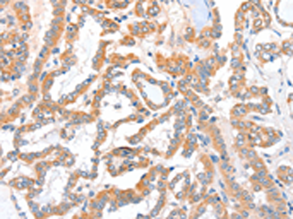 ACSBG1