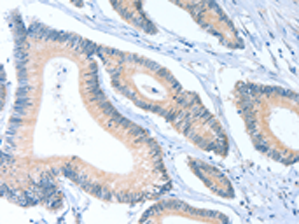 ACTL7B