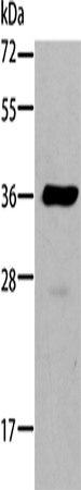 AKR1B10