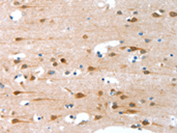 C2CD6