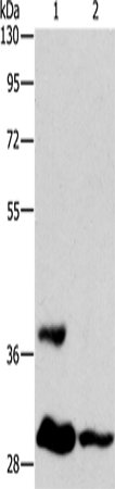 ANKRD54