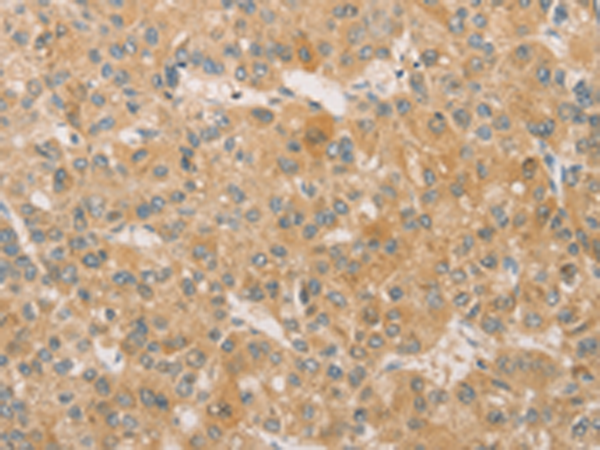 Rabbit Polyclonal Antibody to SNAP91